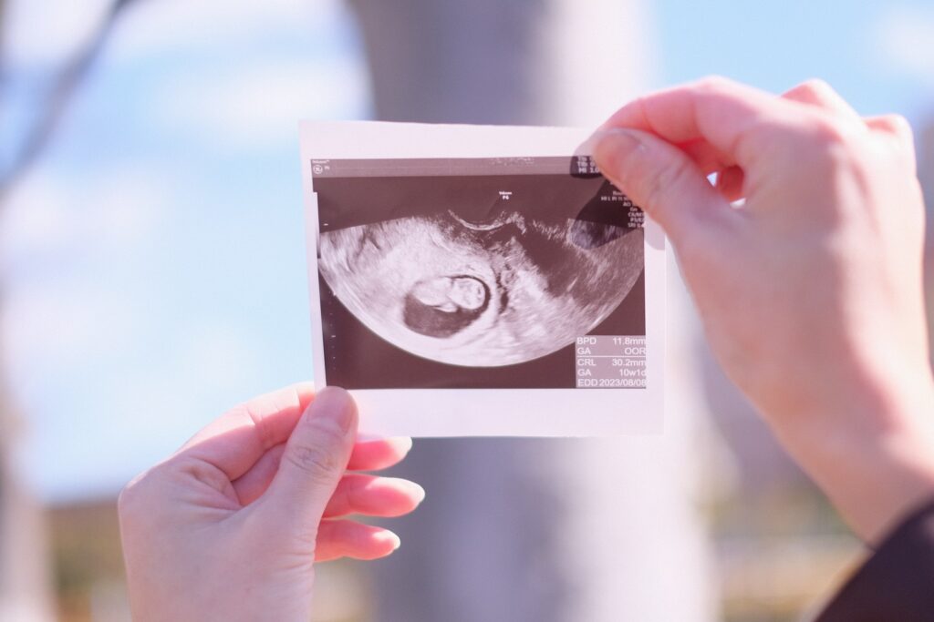 胎児スクリーニング外来