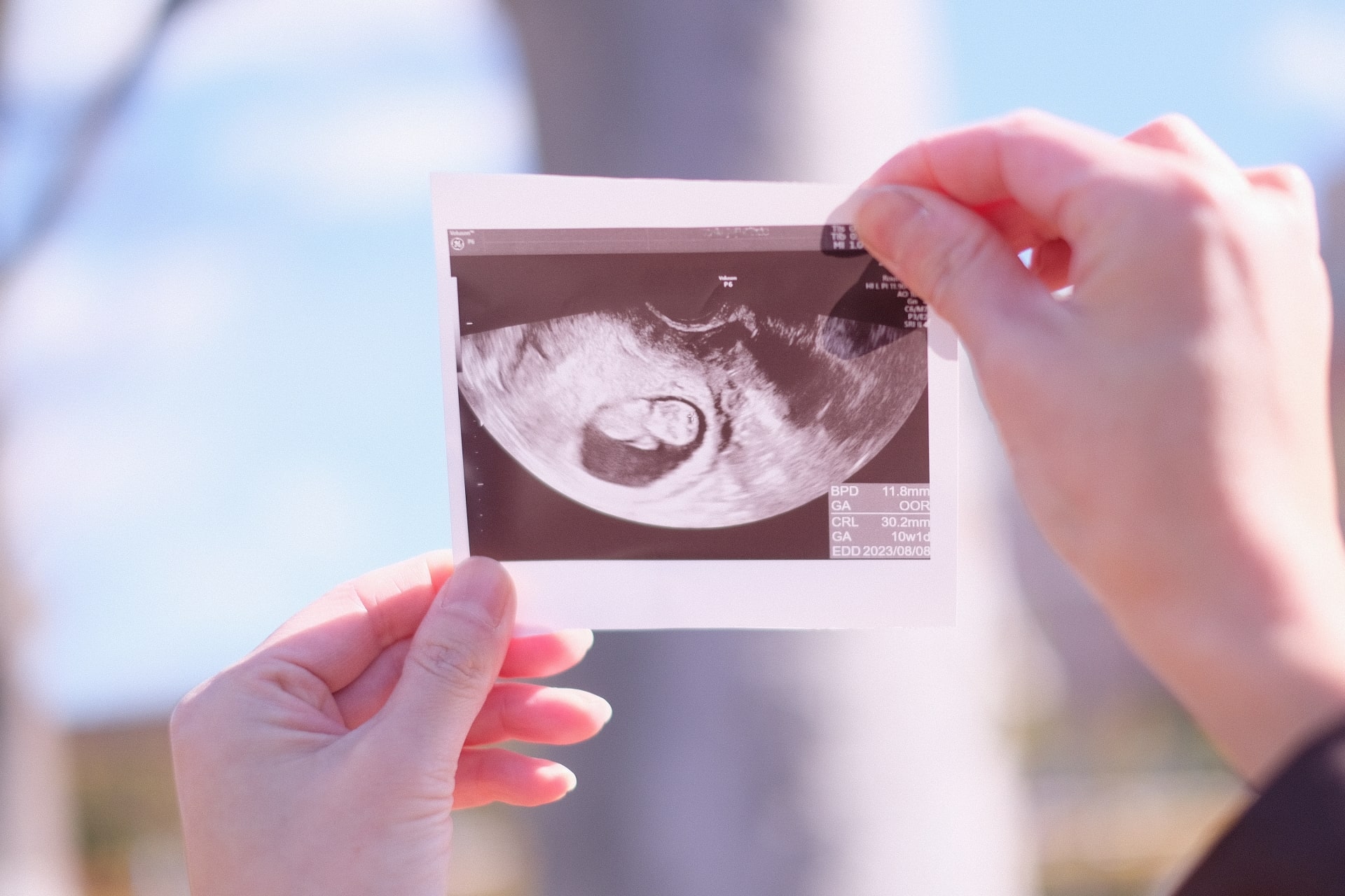 胎児の超音波エコー写真を掲げて眺めている写真です。