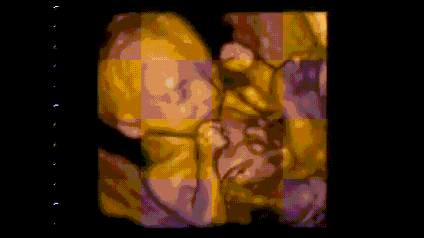 お腹の中にいる胎児の4D超音波映像のGIF動画です。