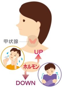 甲状腺の位置と、ホルモン量に応じて起こる症状を表したイラスト画像です。ホルモン量が増えると代謝が上がり汗かきになり、ホルモン量が下がると代謝が下がり冷え性になります。