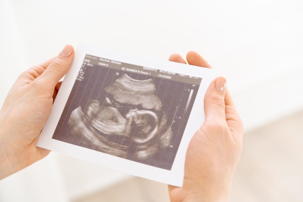 出生前診断の目的（意義）について